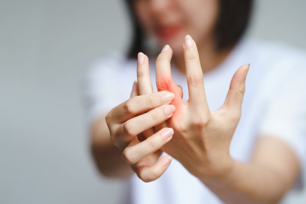 Rheumatoid Arthritis